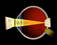 Normal Vision
