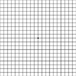 Amsler Grid | Central Valley Eye Medical Group | Stockton, CA Amsler Grid | Central Valley Eye Medical Group | Stockton, CA