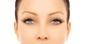 A woman with pre-surgery markings for eyelid surgery.