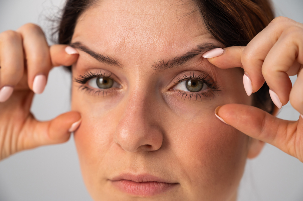 A close-up shot of a woman with ptosis holding her eyes open