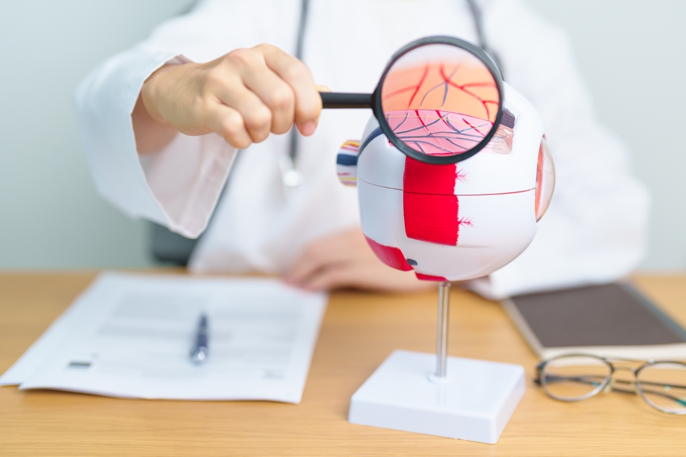 Doctor showing a model of an eye, zoomed in on the inflamed blood vessels that can be a side-effect of diabetes.